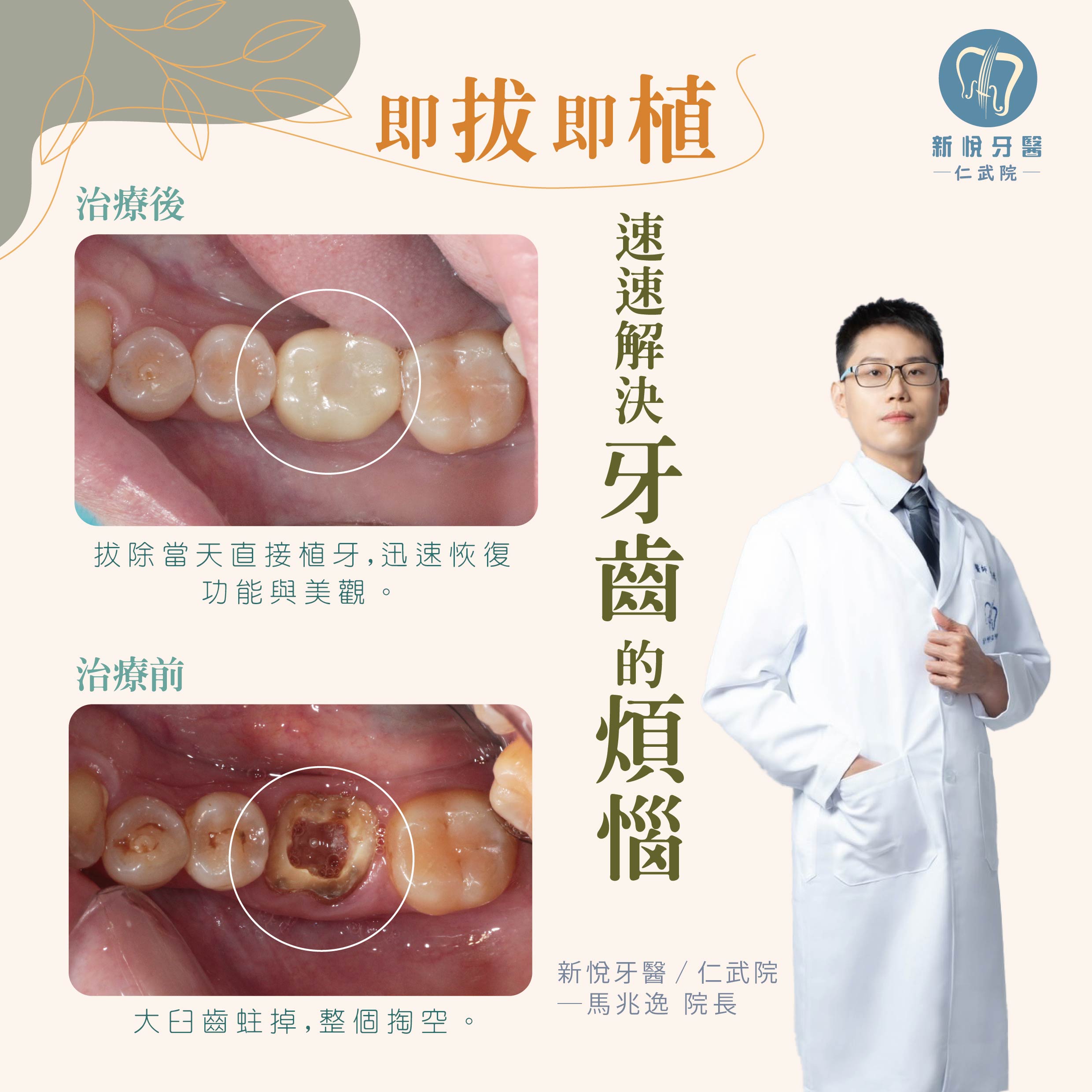 新悅美學牙醫診所的案例分享圖片